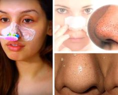 How To Remove Blackheads With A DIY Mask And A Toothbrush