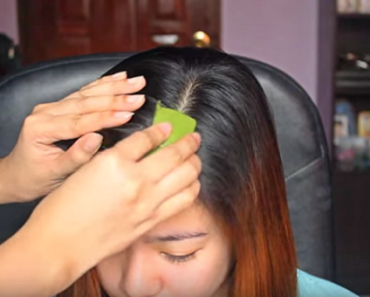 DIY Moisturizing Remedies For Dry Itchy Scalp And Dandruff