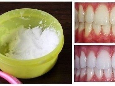 How to DIY Natural Teeth Whitening in Minutes at Your Home