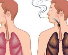 How To Detox Your Lungs After You Quit Smoking
