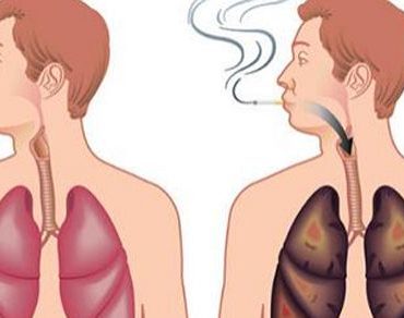 How To Detox Your Lungs After You Quit Smoking