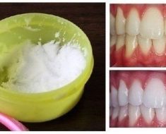 How to DIY Natural Teeth Whitening in Minutes at Home