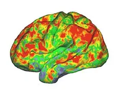 Psilocybin temporarily dissolves brain networks